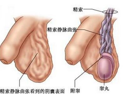 阴囊疼痛是怎么回事