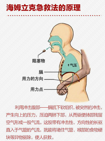 银川一老人遭糯米丸子卡喉咙丧生!这个救命方法一定要看!