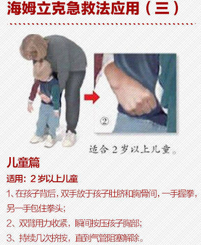 银川一老人遭糯米丸子卡喉咙丧生!这个救命方法一定要看!
