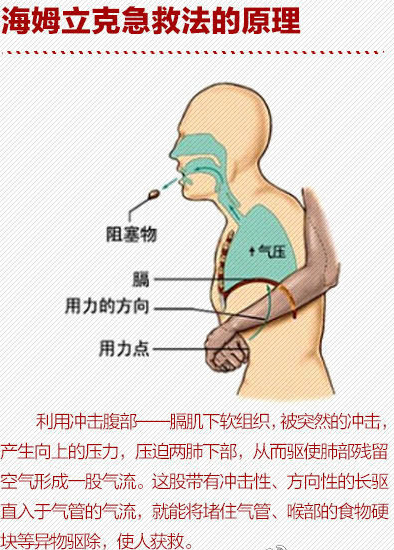 鱼刺卡喉吞饭团?扬州大妈这样做差点丢了命