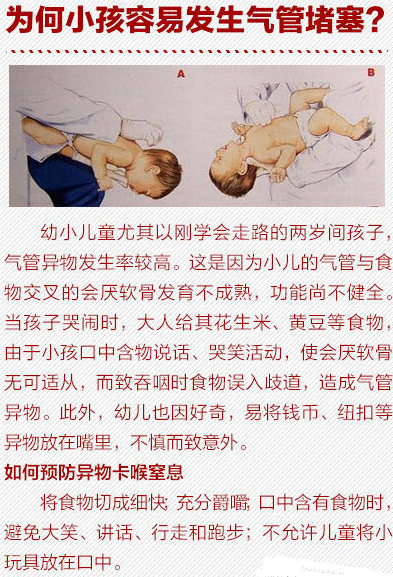 鱼刺卡喉吞饭团?扬州大妈这样做差点丢了命