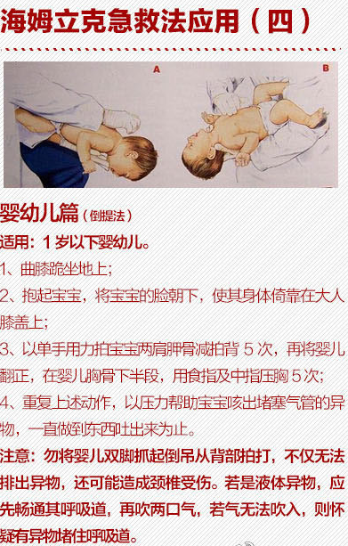 鱼刺卡喉吞饭团?扬州大妈这样做差点丢了命
