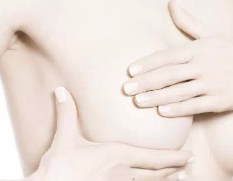 什么叫乳腺增生结节