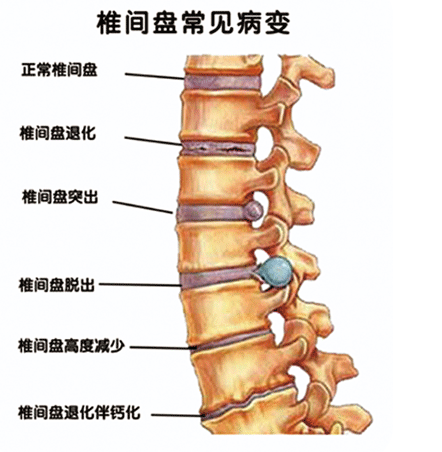 女人腰酸是什么原因引起的