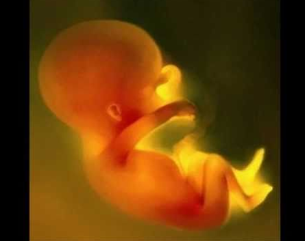 胎儿不发育的原因