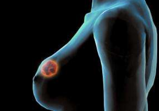 乳房长纤维瘤怎么办