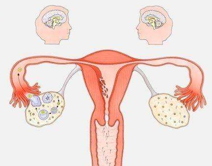 卵巢早衰的治疗方法