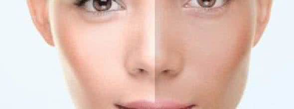脸部皮肤美白的两大方法 让你快速变白