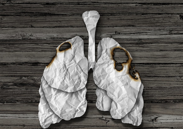 肺癌的早期症状都有哪些？
